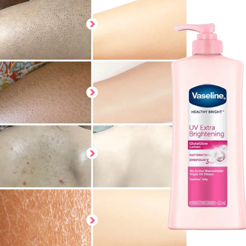 Hidratante Pele Vaselina Loção Corporal